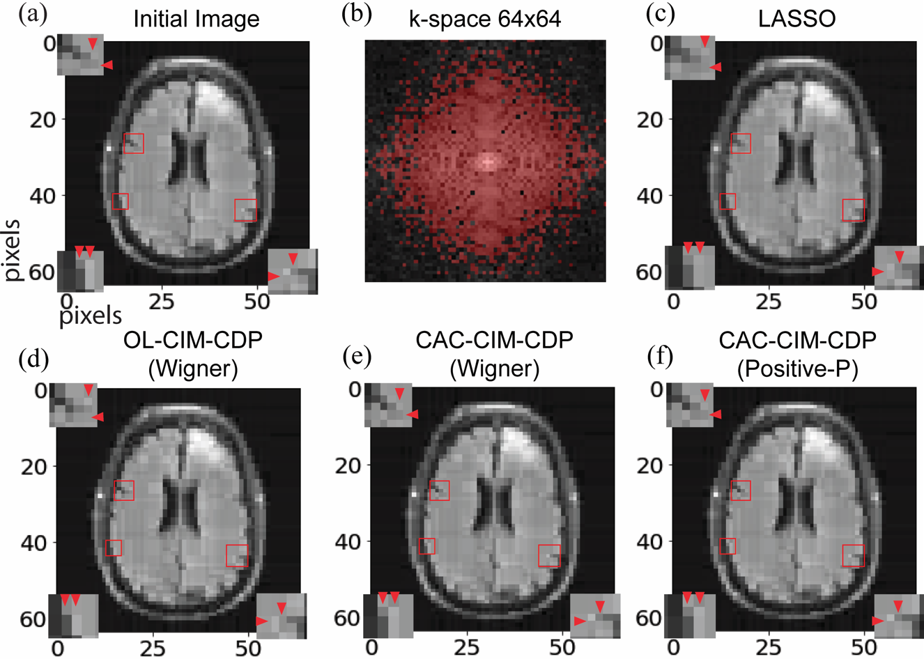 MRI reconstruction